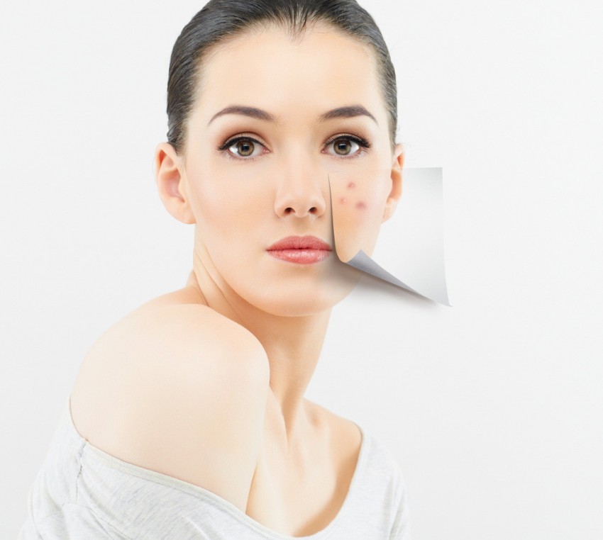 Прыщи на подбородке - лечение, причины появления и варианты восстановления кожи. 105 фото и видео рекомендаций врачей