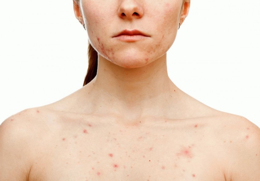 Аллергия на лице цвета кожи