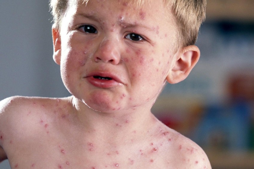 Лекарственная аллергия на лице фото
