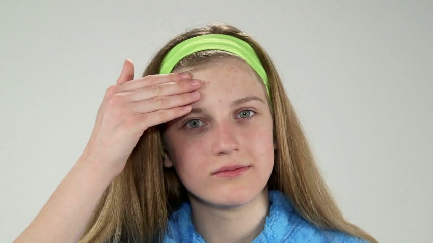 Прыщи у подростков: причины, варианты лечения и маскировки. Современные препараты и народные средства (видео + 120 фото)