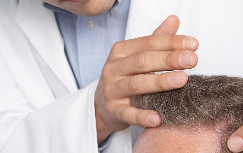 Важные момент по обращению к дерматологу при заболевании волос.